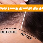 پی آر پی مو