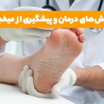 فریز کردن میخچه