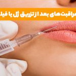 مزایا تزریق ژل