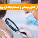 چه نوع خالهایی خطرناک هستند