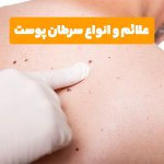 علائم سرطان پوست