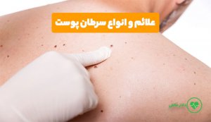 علائم سرطان پوست