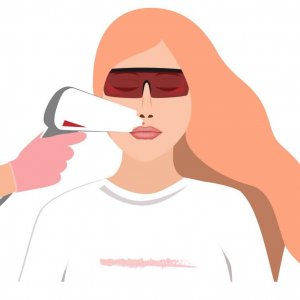 laser-hair-removal--
